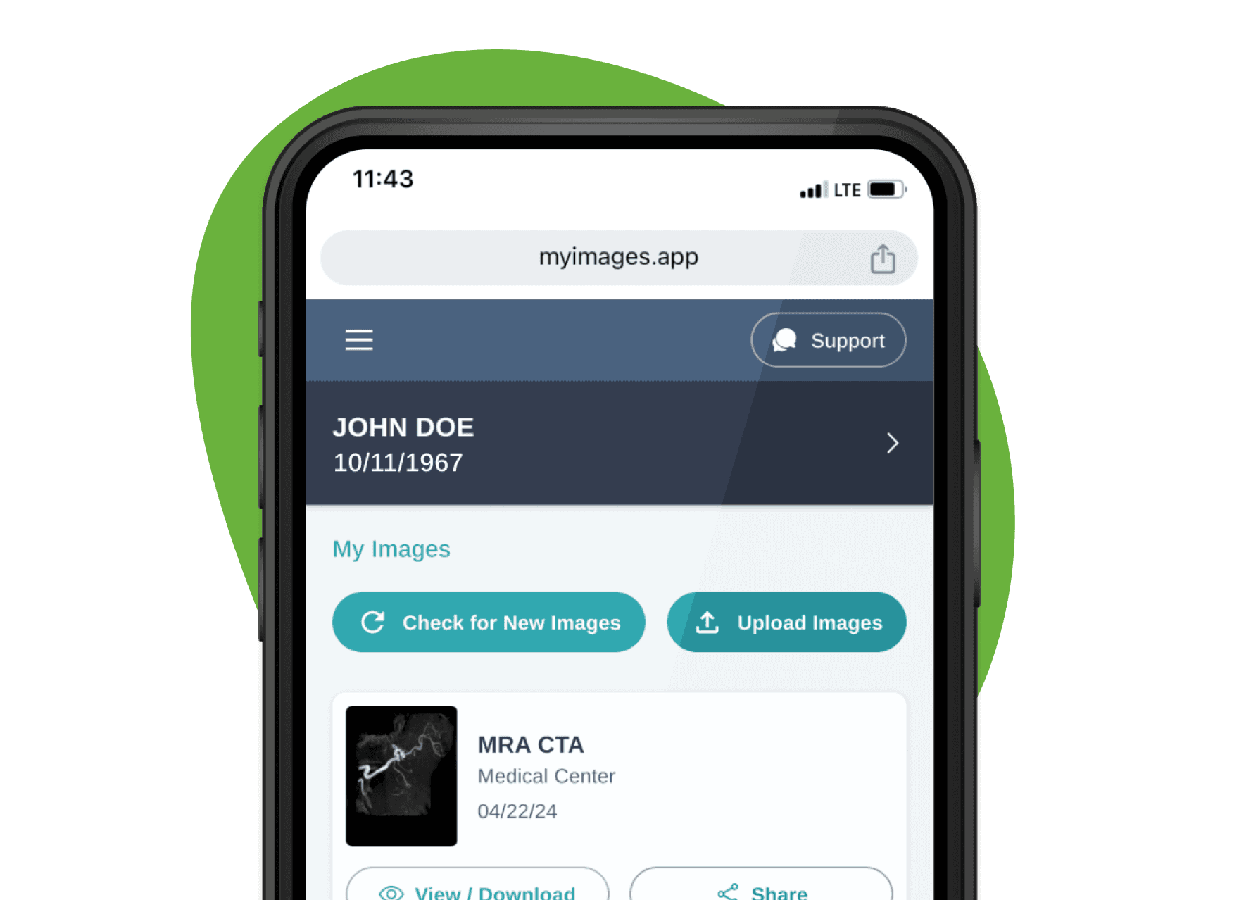 MyImage app interface on mobile phone showing patient John Doe's profile with MRA CTA medical scan from Medical Center, featuring Check for New Images and Upload Images buttons with view/download and share options